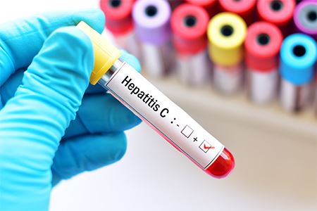 a blood vial with a label that says Hepatitis C